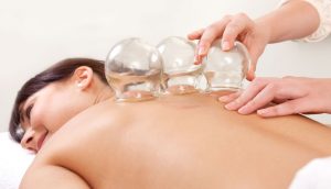 cupping therapy