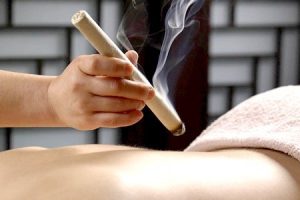 moxibustion